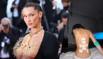 Bella Hadid, Hastalığını Duyurdu!