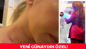 ÖZEL HABER: Ece Seçkin Saldırıya Uğradı!