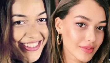 Dilan Çiçek Deniz'in Estetiksiz Hali Gündem Oldu!