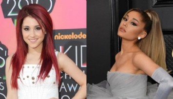 Ariana Grande: 'Birçok Kez Botoks Yaptırdım'