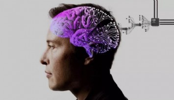 İnsan Beynine Çip Yerleştirildi!