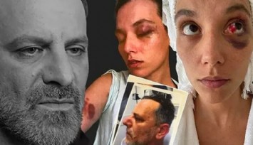 Ozan Güven'i Zora Sokacak Rapor!