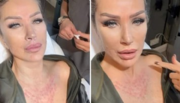 Seda Sayan, Sünnet Derisinden Sıvı Enjekte Ettirdi!