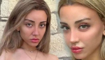 Mika Raun Kanlar İçinde Fotoğrafını Paylaştı!